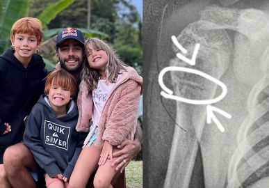 Luana Piovani revela que filho fraturou o ombro: <I>Corre para o hospital</i>