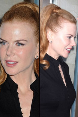 <i>Botox</i>?: Nicole Kidman usa o <i>Croydon Facelift</i>