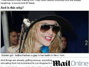 Pirata: Ke$ha sorri e mostra dente de ouro