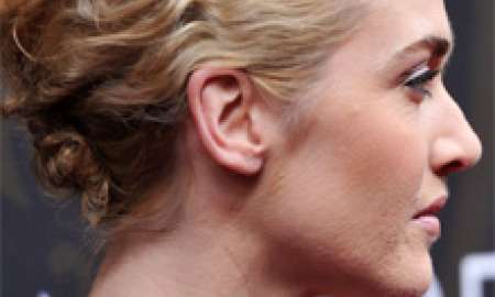 Flagra: Kate Winslet exibe rosto cheio de pelos