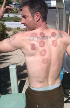 David Arquette exibe manchas nas costas no <i>Twitter</i>