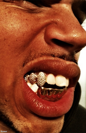Chris Brown posa com capa metálica nos dentes