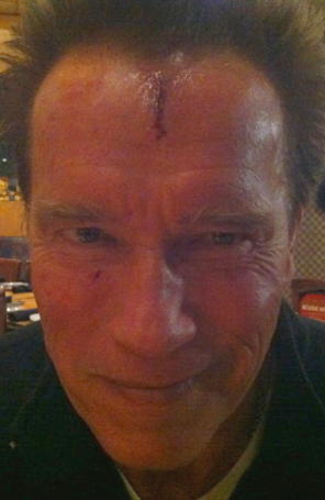 Arnold Schwarzenegger se machucou no set de <i>The Last Stand</i>