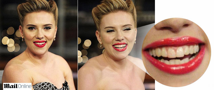 Scarlett Johansson aparece com mancha de batom nos dentes na TV