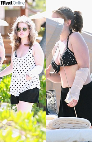 Kelly Osbourne exibe braço engessado durante férias no Havaí