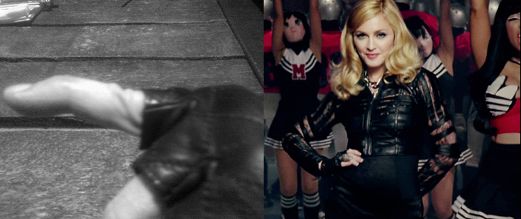 Madonna posta foto de dedo quebrado durante ensaio