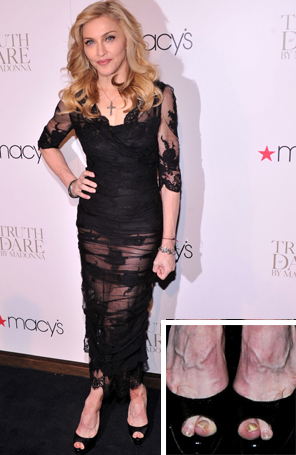 Madonna mostra as unhas do pé descuidadas no tapete vermelho