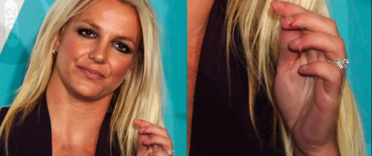 Britney Spears foi clicada com os dedos sangrando