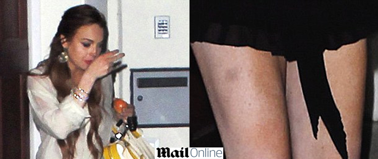Lindsay Lohan exibe manchas na pele