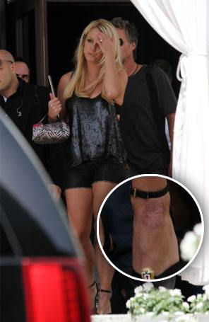 Com pé machucado, Britney Spears deixa gravações de <i>X Factor</i>
