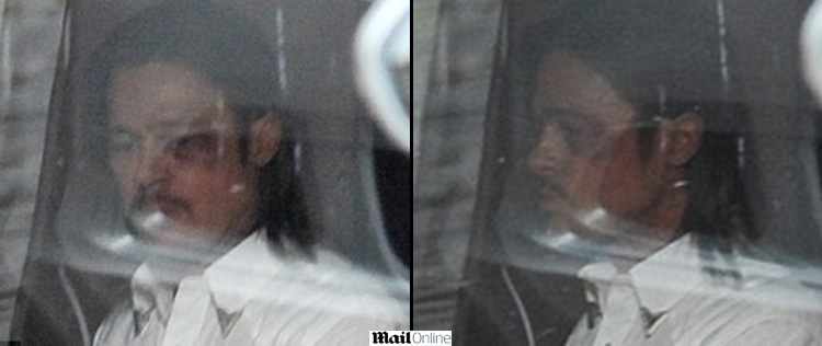Brad Pitt aparece machucado em <I>set</i>