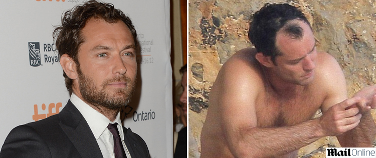 Jude Law levanta suspeitas de implante capilar