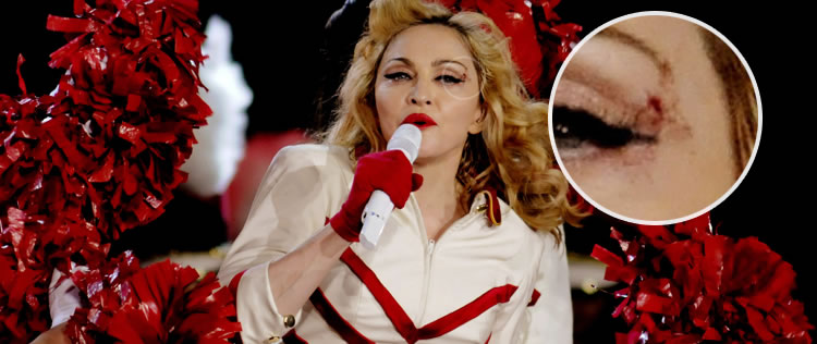 Madonna se machuca e termina <I>show</i> sangrando na Colômbia