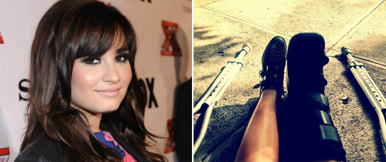 Demi Lovato machuca a perna
