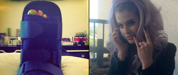 Kelly Osbourne machuca o pé e posta foto, veja!