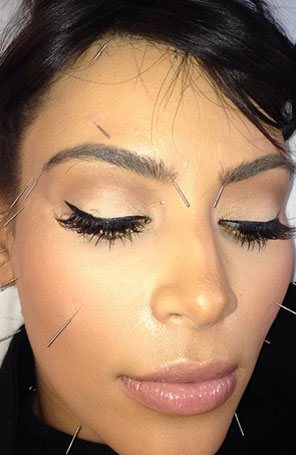Kim Kardashian posta foto com o rosto cheio de agulhas