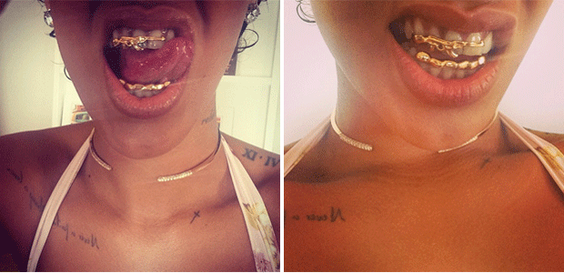 Rihanna posta foto com acessório nos dentes, veja aqui!