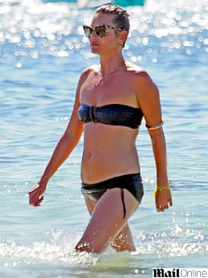 Kate Moss exagera no sol e fica com a pele vermelha