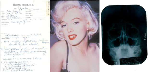 Provas de cirurgias plásticas de Marilyn Monroe vão a leilão