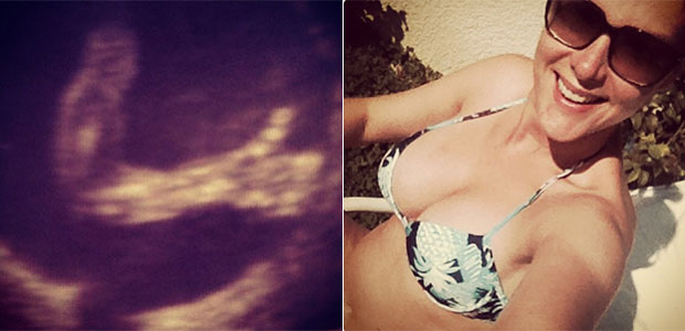 Ana Hickmann mostra ultrassom do filho fazendo sinal de joia
