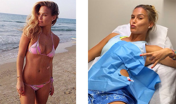 Bar Refaeli tira verruga da barriga e mostra foto