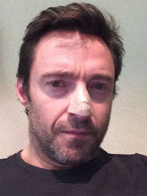 Hugh Jackman revela que está em tratamento contra o câncer de pele