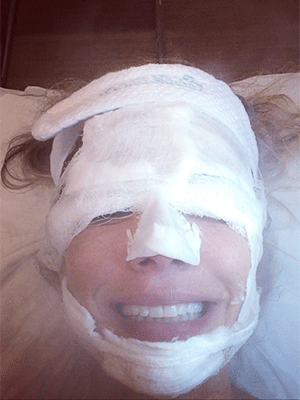 Luciana Gimenez posta foto em que aparece com o rosto coberto de curativos