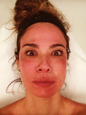 Luciana Gimenez posta foto com o rosto todo vermelho