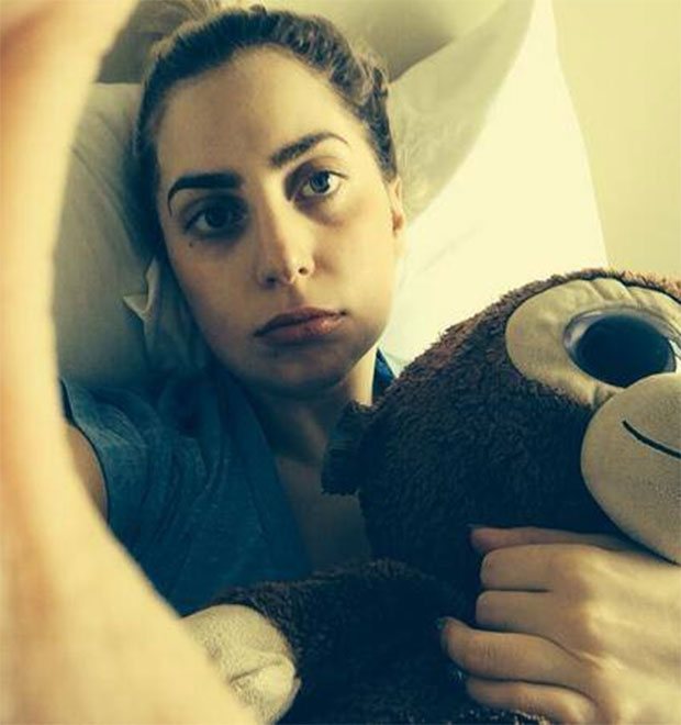 Lady Gaga tira os dentes do siso e posta foto sem maquiagem