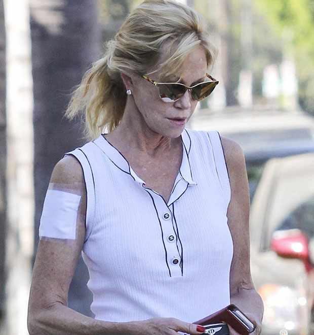 Melanie Griffith aparece com curativo no braço após tentar remover tatuagem