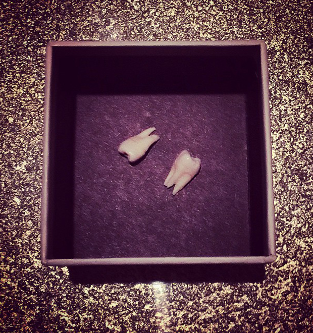 Kelly Osbourne vai presentear pai com dente do siso. Entenda!