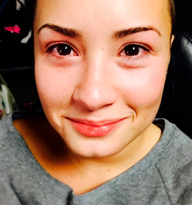 Demi Lovato brinca com gatinho e fica com os olhos inchados. Entenda!