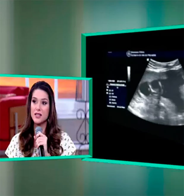 Fernanda Machado comemora gravidez no <i>Encontro com Fátima Bernardes</i> e mostra ultrassom!