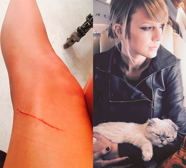 Taylor Swift é atacada por gata de estimação