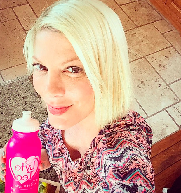 Tori Spelling sofre queimadura em grelha de restaurante e precisa fazer enxerto de pele