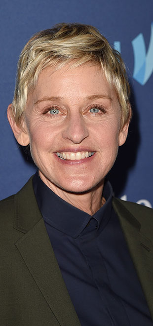 Ellen DeGeneres teria feito procedimento estético no pescoço, diz <i>site</i>