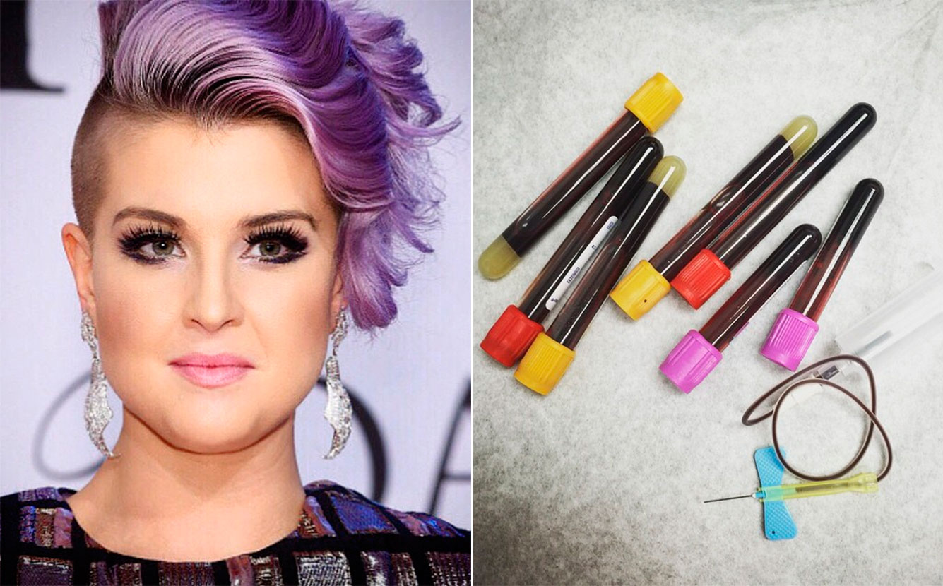 Kelly Osbourne tira sete frascos de sangue após ser picada por aranha venenosa!