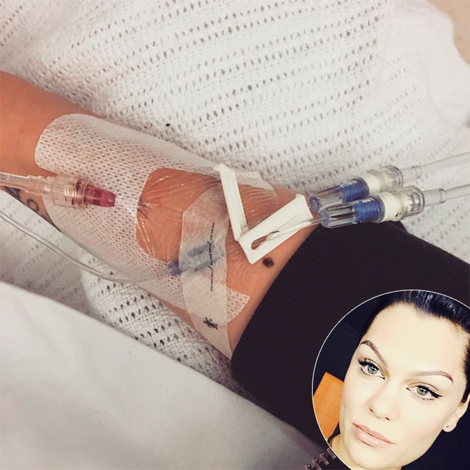 Jessie J continua em recuperação e diz que sente muita dor