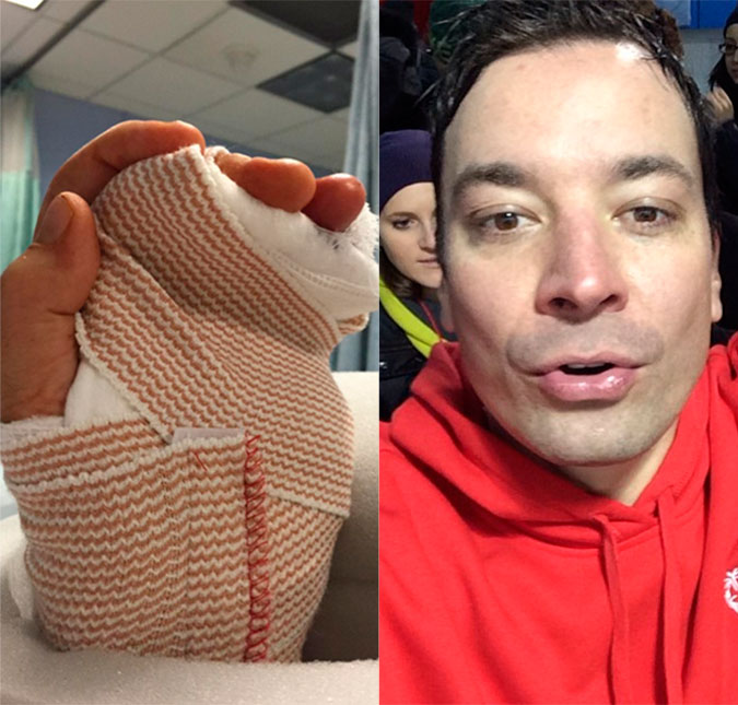 Depois de cirurgia, Jimmy Fallon compartilha foto da mão enfaixada e diz que está bem