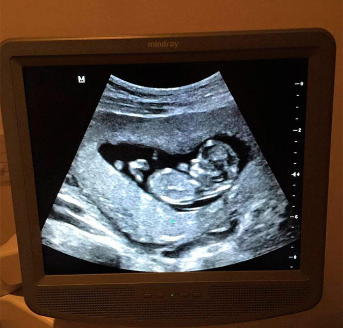 Michael Bublé mostra ultrassom de seu segundo bebê, veja!