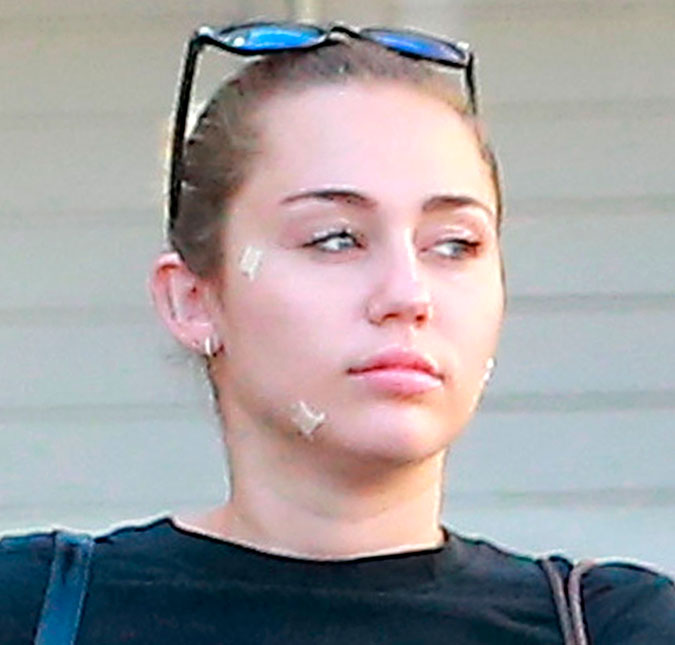 Miley Cyrus é flagrada com curativos pelo rosto
