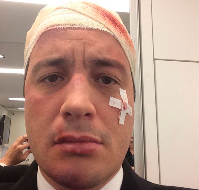 Apresentador do <i>CQC</i> publica foto com cabeça enfaixada após acidente com touro