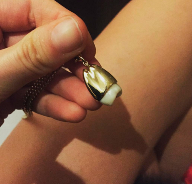 Behati Prinsloo, esposa de Adam Levine, transforma seu dente do siso em um colar de ouro!