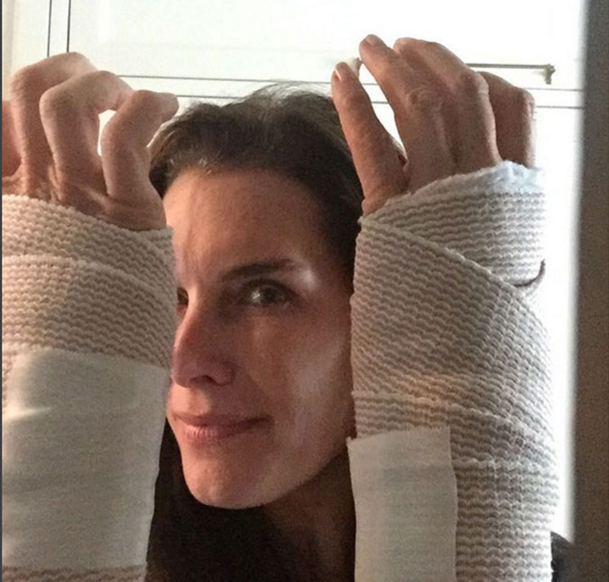 Brooke Shields exibe pulsos com curativos após operação