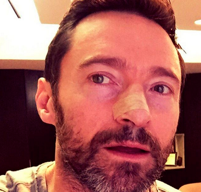 Após tratar novo carcinoma, Hugh Jackman adverte: <i>usem protetor solar</i>