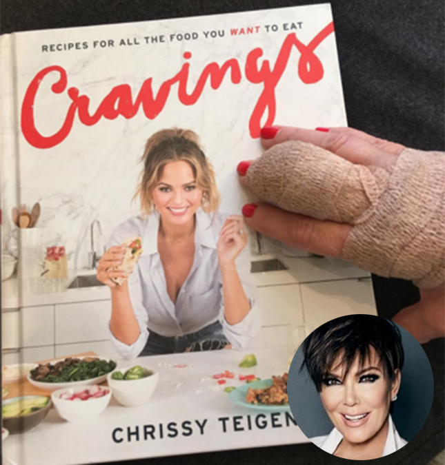 Kris Jenner faz cirurgia na mão e aparece de atadura, veja!