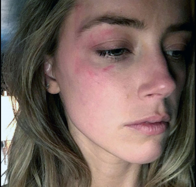 Amber Heard alega ter sofrido violência doméstica e pede ordem de restrição contra Johnny Depp