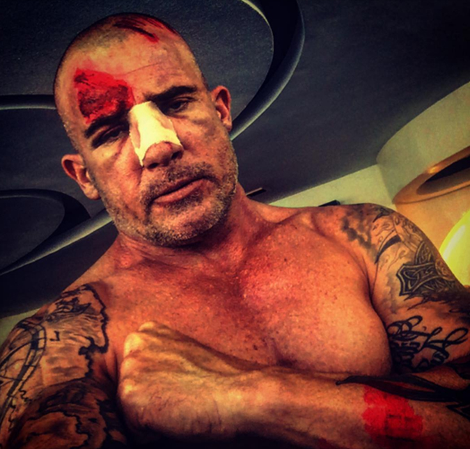 Dominic Purcell, astro de <i>Prison Break</i>, se acidenta no <i>set</i>