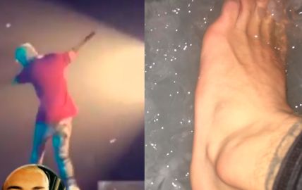 Justin Bieber prova que consegue dançar até de tornozelo machucado, confira!