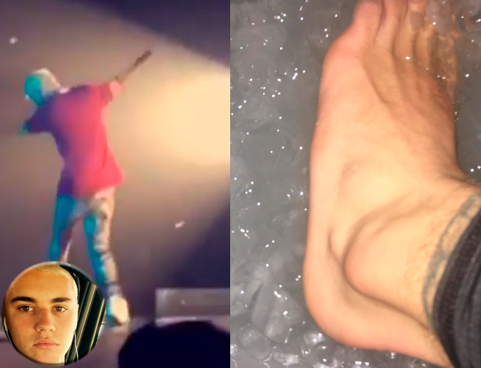 Justin Bieber prova que consegue dançar até de tornozelo machucado, confira!